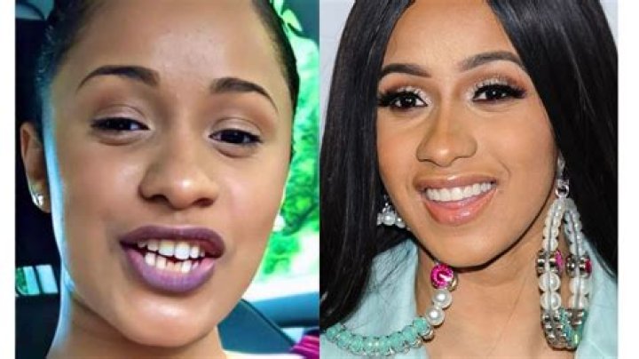 All about Cardi B Teeth Before and After A Best Fashion