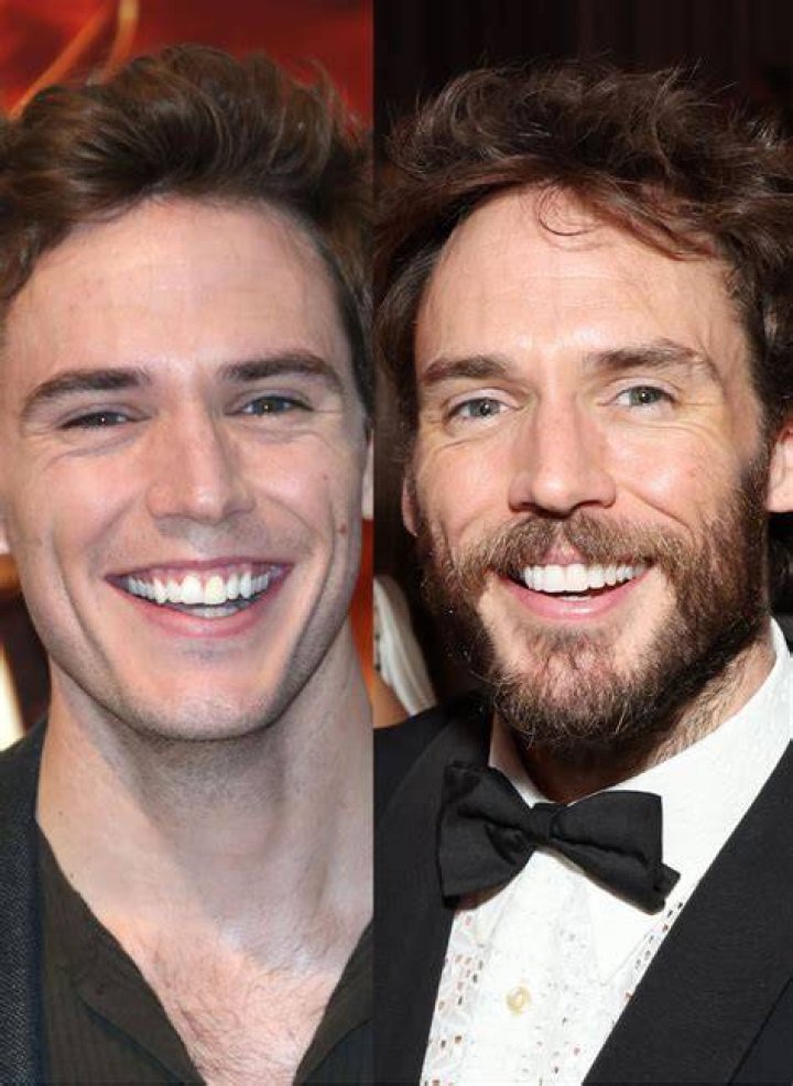 Did Sam Claflin Get Veneers? Here Are 14 Celebrities Before And After
