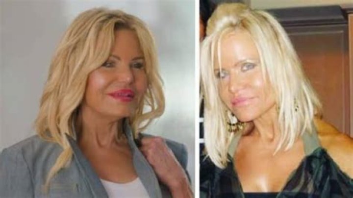 Lisa Helou Plastic Surgery DaiseyAleida