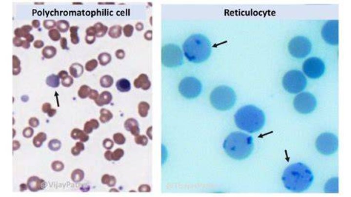 Reticulocyte Stain