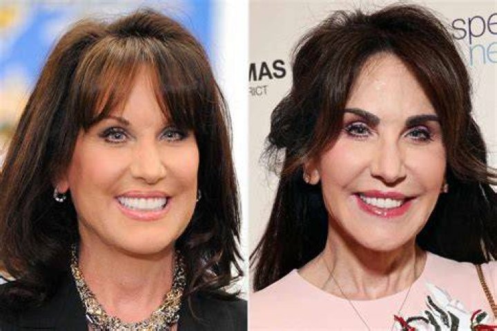 Robin McGraw Reveals She Got an Eyebrow Transplant