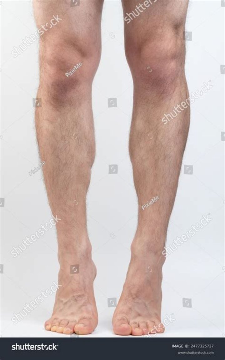 the legs of a person wearing socks with orange and brown designs on