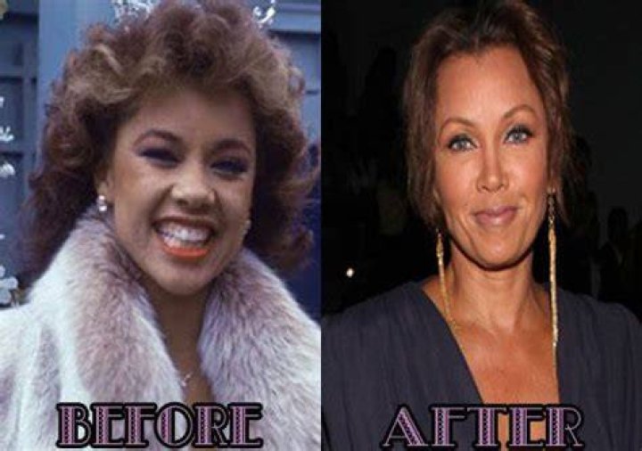 Vanessa Williams nose job